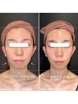 ミエル 神戸店(Miel)/HIRFWAVEハイアールエフウェーブ