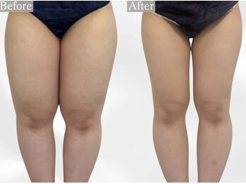 プリマルーチェ/プレミアム下半身プログラム