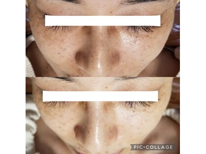 ココット(kokotto)の写真