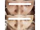 ココット(kokotto)の写真