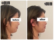 キプラ 福津店(KIPURA)/小顔矯正フェイスラインスッキリ