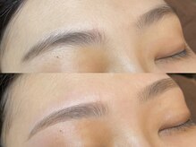 クーム(QUEUEMOU)/BeforeAfter