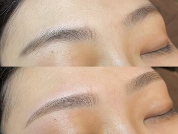 クーム(QUEUEMOU)/BeforeAfter