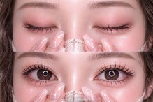 ピピプラス(pipi+)