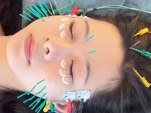 アオヤマ サロン ワイゼット(AOYAMA SALON YZ)/目元すっきり