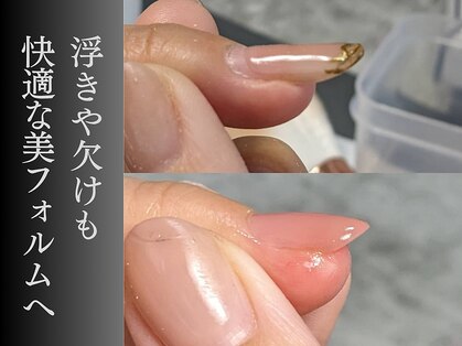 ジップス(zips)の写真