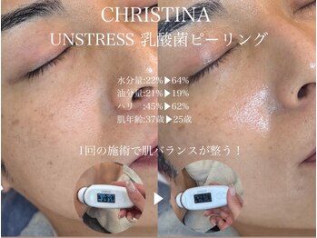 ルチーレ(Lucire)の写真/当店人気NO.2★【クリスティーナ　初回11,000円/2回目以降13,000円】根本からの肌質改善で韓国ツヤ肌へ♪