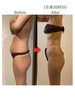 バーチュ(Virtue)/3回の出産経験ありの方