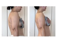 ハートエルボー(Heart elbow)/猫背撃退