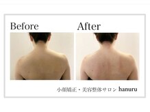 ハヌル(hanuru)の雰囲気（肩の左右差の高さを揃えて背中の厚みも薄く◎施術後、軽さを実感）