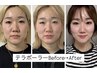 【8月限定】先着5名様まで♪美容小顔矯正カスタマイズコース　60分　￥6100