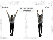 トキ(TOKI)/筋膜リリース美容整体　施術直後