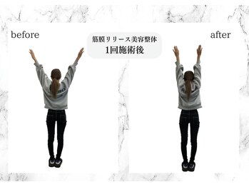トキ(TOKI)/筋膜リリース美容整体　施術直後