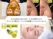 リバース 大波止店