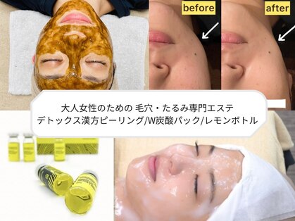 リバース 大波止店の写真