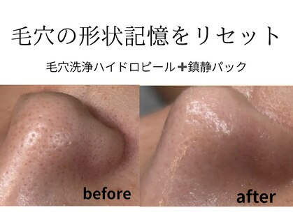 ユズドット(yuzu.)の写真