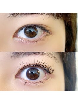 フランセス(Frances)/上下ラッシュリフト