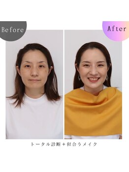 シュアリー(Surely)/トータルコースお客様事例