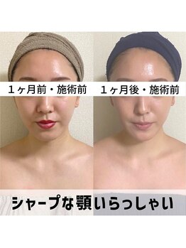 お顔の研究所/ビフォーアフター写真♪