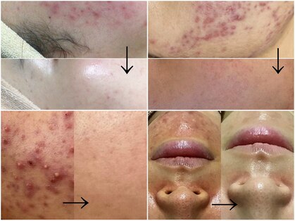 メンズサロンエヌエー(MEN'S SALON NA)の写真