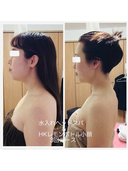 ラヴィソンファム(Ravissant femme)/小顔/脂肪/たるみ/レモンボトル