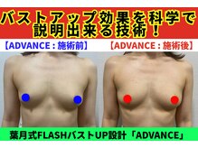 セブンシーズ 上野店(Seven Seas)/バストアップ/豊胸/東京都/上野