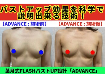 セブンシーズ 上野店(Seven Seas)/バストアップ/豊胸/東京都/上野