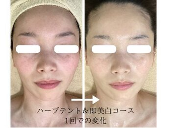 こもれび/１回のお手入れでの変化