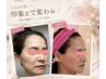【1500円特典付】ペア利用OK!韓国最新コラーゲン注入★2回券¥33000
