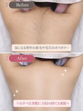 アルゴ 高槻店(ALGO) ビフォー アフター