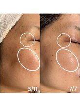 楚々(SOSO)/before after