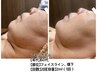 脂肪分解！【レモンボトル】お待たせしました！小顔矯正、二重アゴに