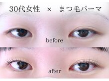 セイン 根津 千駄木(Sein)/左右差でお悩みの方も当店へ