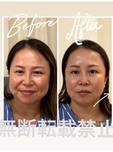 ヨサパーク ラブリエ 吉祥寺店(YOSA PARK La Briller)/水素吸入で目の大きさも変化！