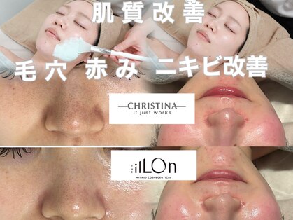 アンリミット 原宿竹下通り店(Une limit)の写真