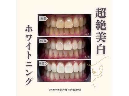 ホワイトニングショップ 福山店の写真