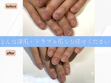 ブルームーンネイルズ(BLOOMOON.nails)