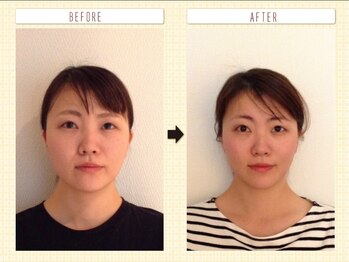 美容整体ウェリナ あま甚目寺院/小顔矯正/骨盤矯正/美脚サロン