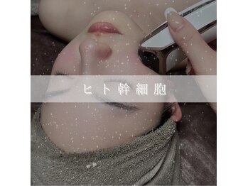 アムリリー 南草津店(AMRILY)/ベビースキントリートメント