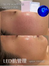 ジェノール 飾磨本店(JNOEL)/LED肌管理×nuniパック