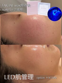 ジェノール 飾磨本店(JNOEL)/LED肌管理×nuniパック