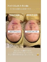 クレール 小山店(CLAIR)/【美肌フォト+エレポレ】