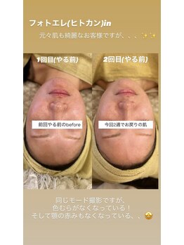 クレール 小山店(CLAIR)/【美肌フォト+エレポレ】