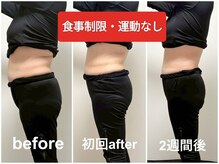 ヨサパーク フルラージュ(YOSA PARK Fleurage)