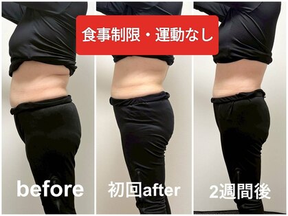 ヨサパーク フルラージュ(YOSA PARK Fleurage)の写真