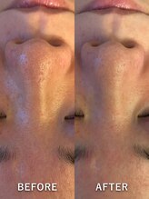 もみほぐし～ぷカンバラ(KAMBARA)/【ハイドラフェイシャル】