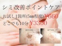 脱毛サロン ラミー(Lamie)の雰囲気（気になるシミをピンポイントでケア♪繰り返しの施術で徹底的ケア）