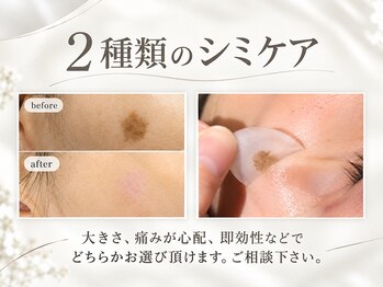 アウラ(AURA)の写真/【堺市初！塗るだけシミケア】塗るだけだけなのにポロっと落ちる驚きのシミケアです♪是非お試し下さい♪