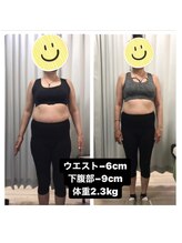 くまがい整体院 若松店/骨盤矯正＋EMS