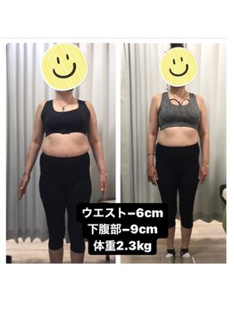 くまがい整体院 若松店/骨盤矯正+EMS